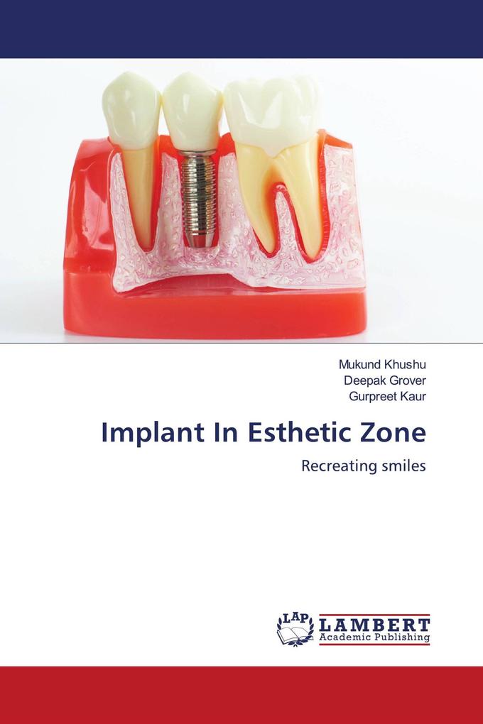 Implant In Esthetic Zone
