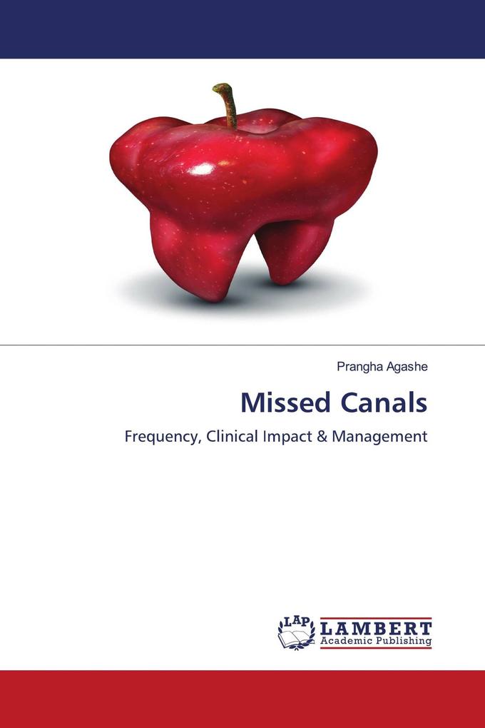 Missed Canals