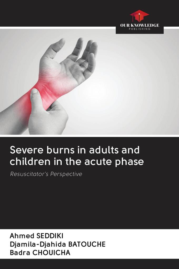 Severe burns in adults and children in the acute phase