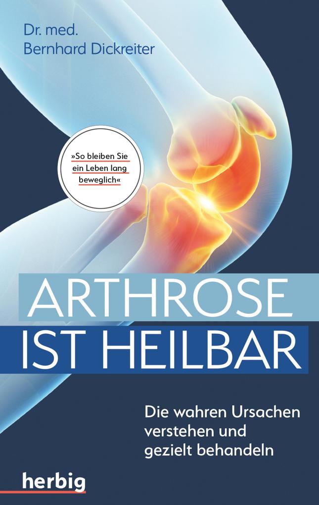 Franckh-Kosmos Arthrose Ist Heilbar