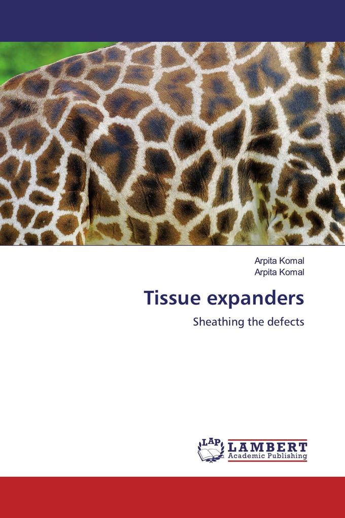 Tissue expanders