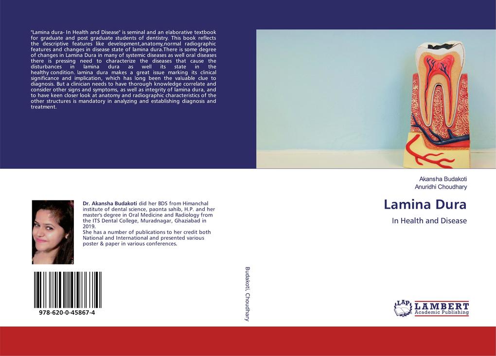 Lamina Dura