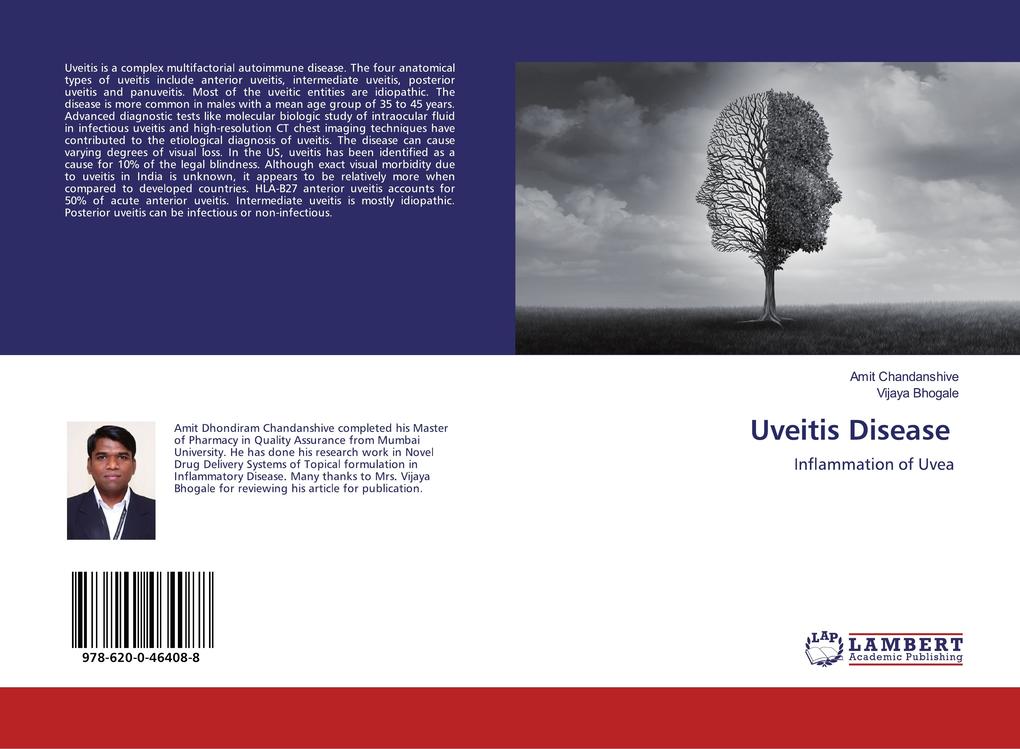 Uveitis Disease
