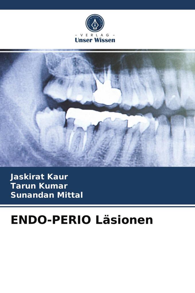 ENDO-PERIO Läsionen