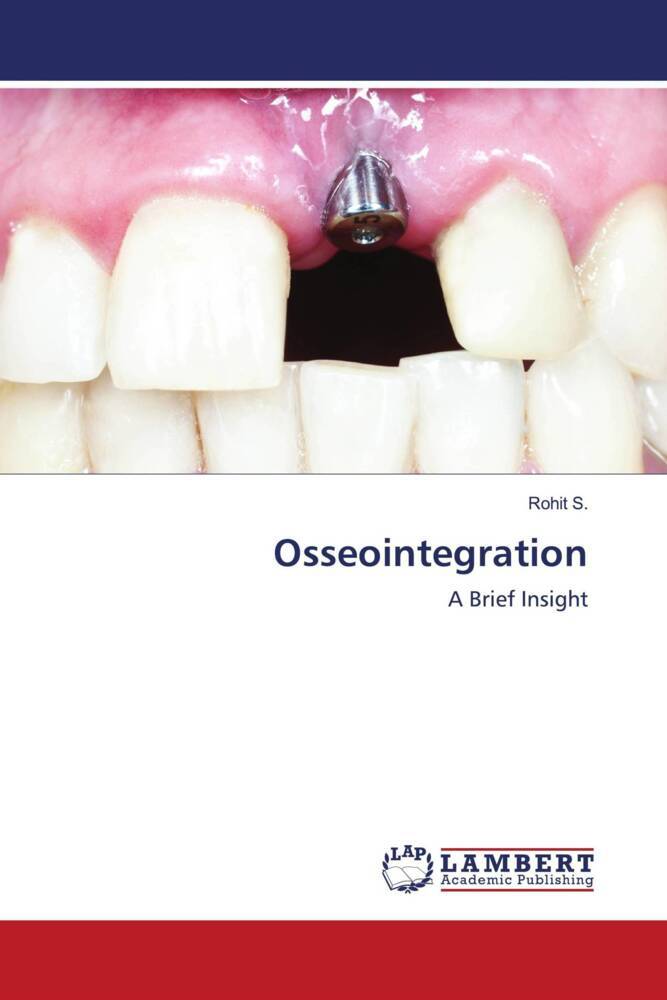 Osseointegration
