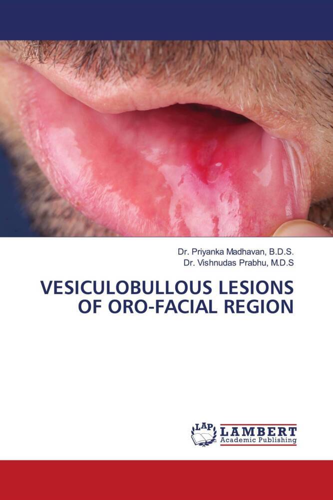 VESICULOBULLOUS LESIONS OF ORO-FACIAL REGION