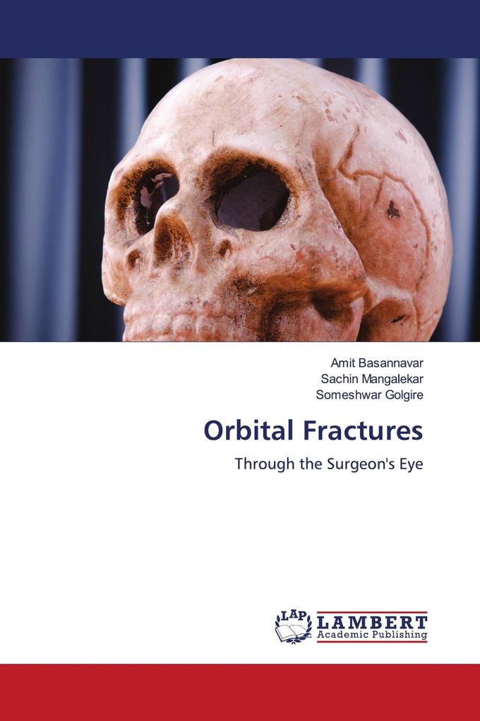 Orbital Fractures
