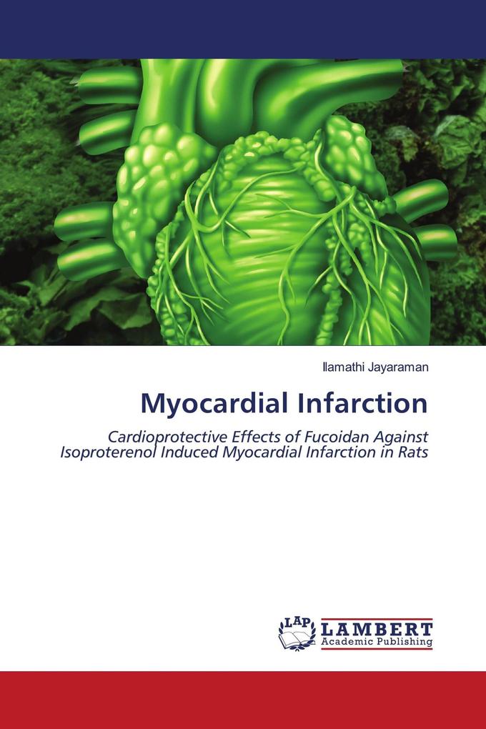 Myocardial Infarction
