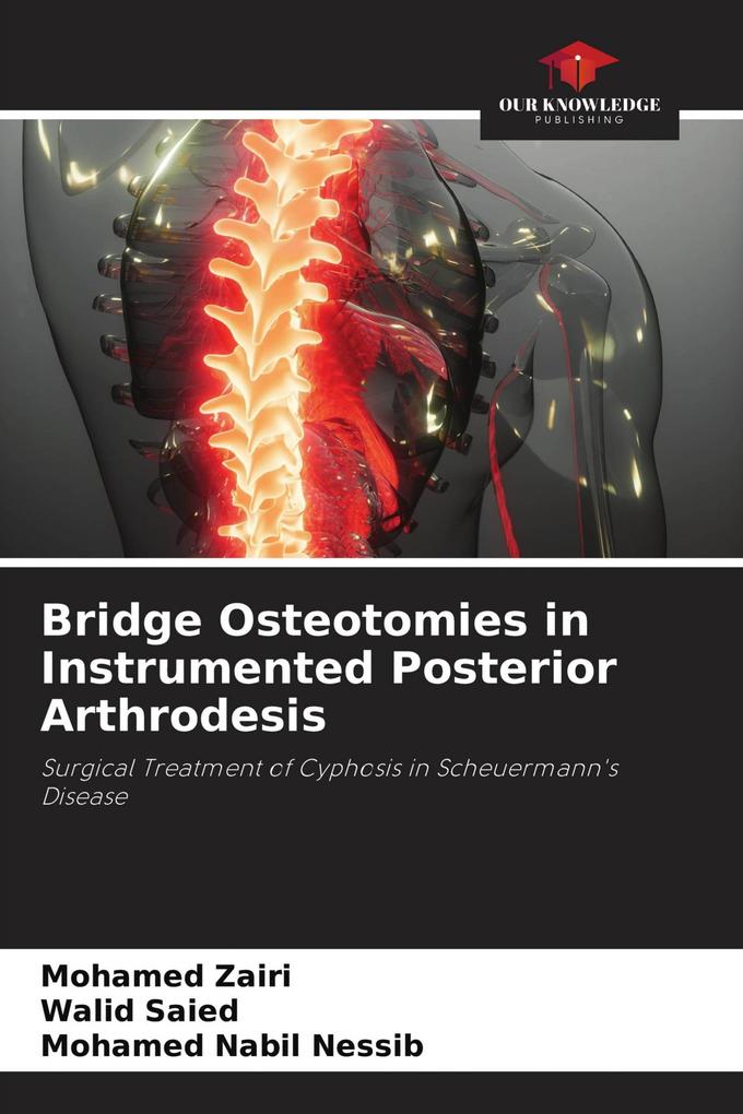 Bridge Osteotomies in Instrumented Posterior Arthrodesis
