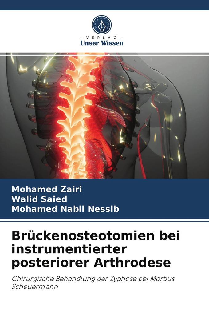Brückenosteotomien bei instrumentierter posteriorer Arthrodese