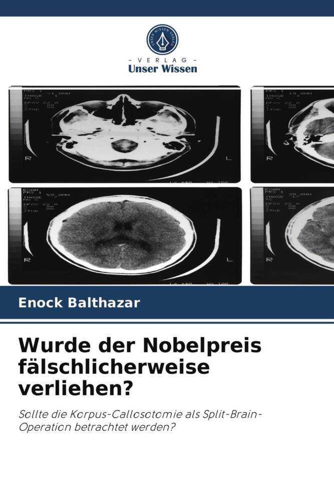 Wurde der Nobelpreis fälschlicherweise verliehen?