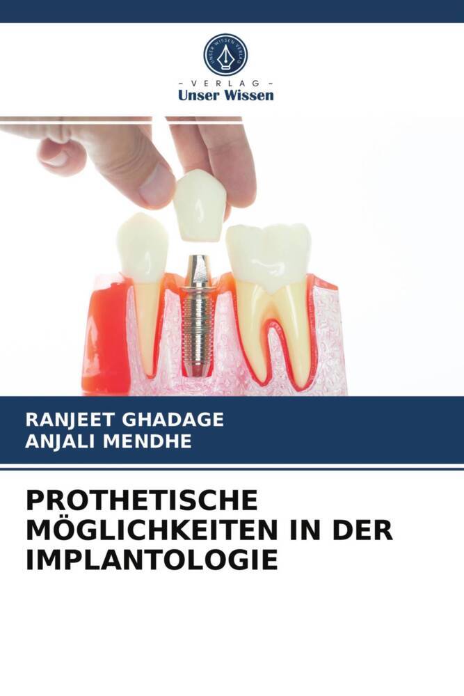 PROTHETISCHE MÖGLICHKEITEN IN DER IMPLANTOLOGIE