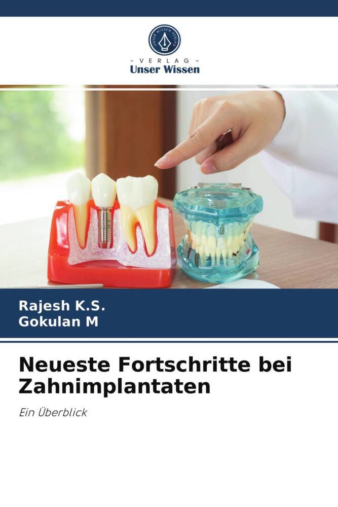 Neueste Fortschritte bei Zahnimplantaten