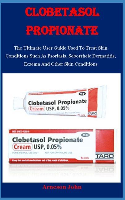 Clobetasol Propionate: The Ultimate User Guide Used To Treat Skin Conditions Such As Psoriasis Seborrheic Dermatitis Eczema And Other Skin