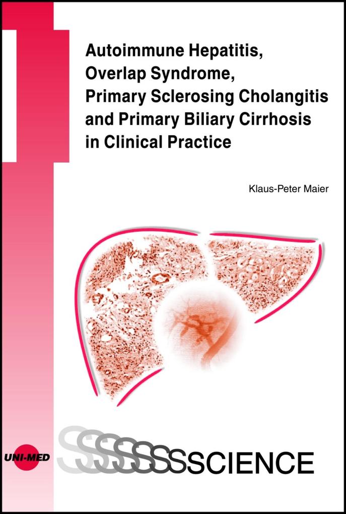 Autoimmune Hepatitis Overlap Syndrome Primary Sclerosing Cholangitis and Primary Biliary Cirrhosis in Clinical Practice