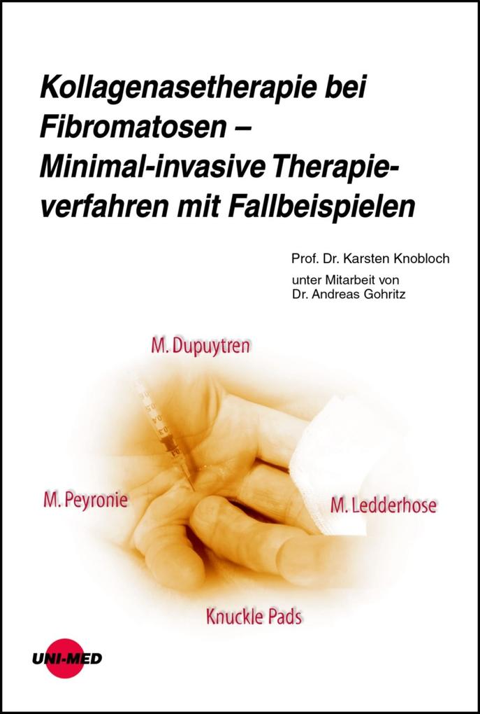Kollagenasetherapie bei Fibromatosen - Minimal-invasive Therapieverfahren mit Fallbeispielen