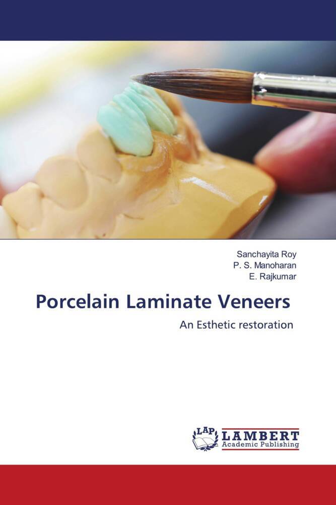 Porcelain Laminate Veneers
