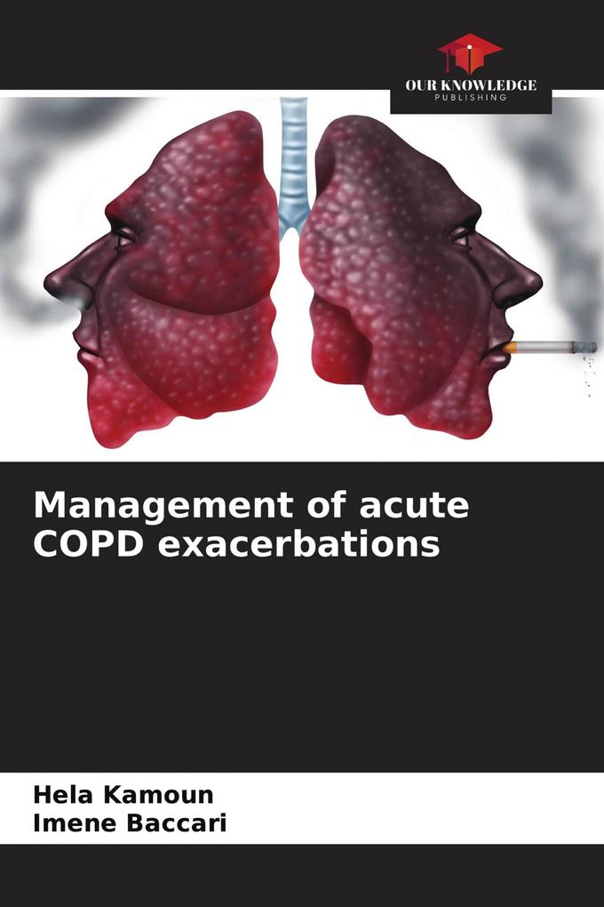 Management of acute COPD exacerbations