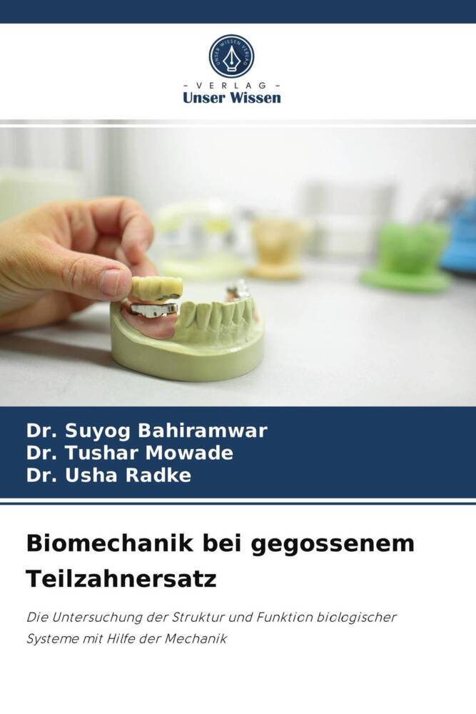 Biomechanik bei gegossenem Teilzahnersatz