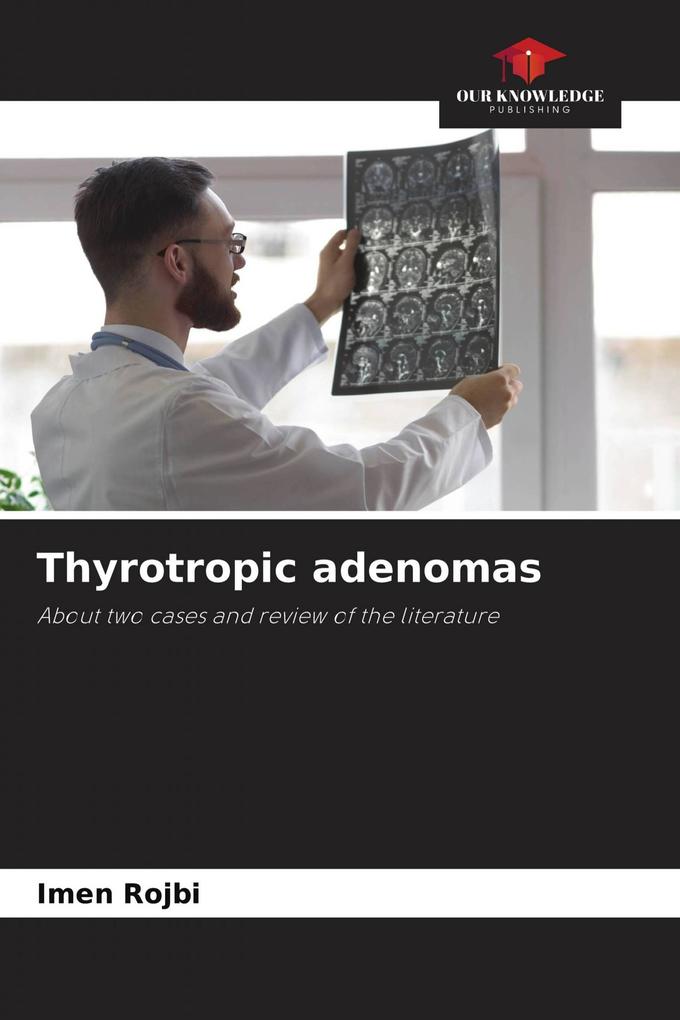 Thyrotropic adenomas