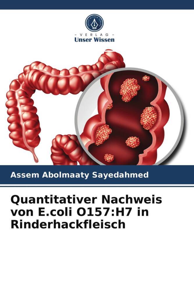 Quantitativer Nachweis von E.coli O157:H7 in Rinderhackfleisch