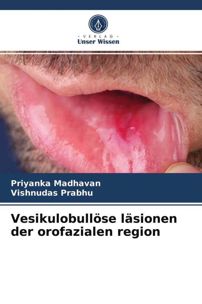 Vesikulobullöse läsionen der orofazialen region