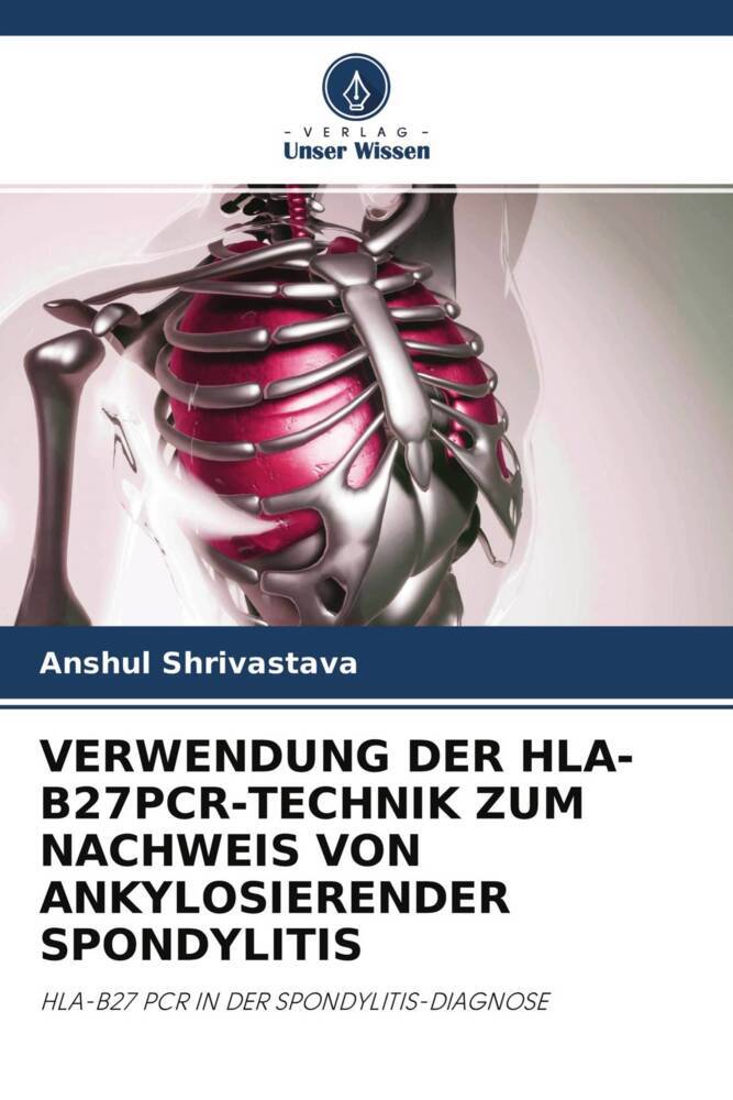 VERWENDUNG DER HLA-B27PCR-TECHNIK ZUM NACHWEIS VON ANKYLOSIERENDER SPONDYLITIS