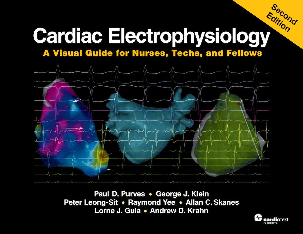 Cardiac Electrophysiology: A Visual Guide for Nurses Techs and Fellows Second Edition