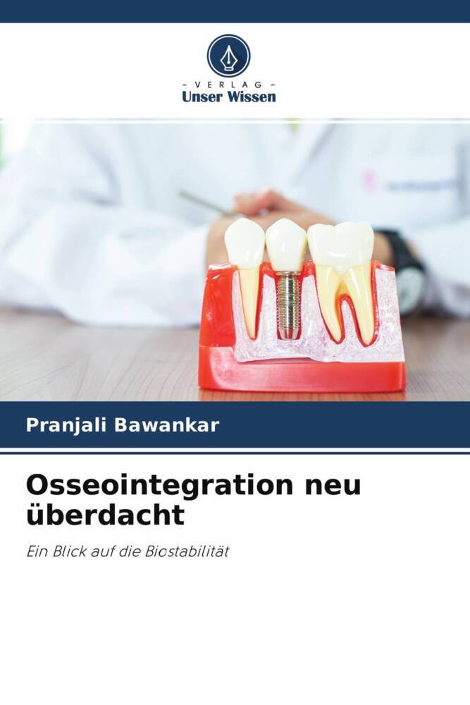 Osseointegration neu überdacht