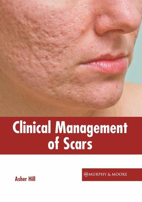 Clinical Management of Scars