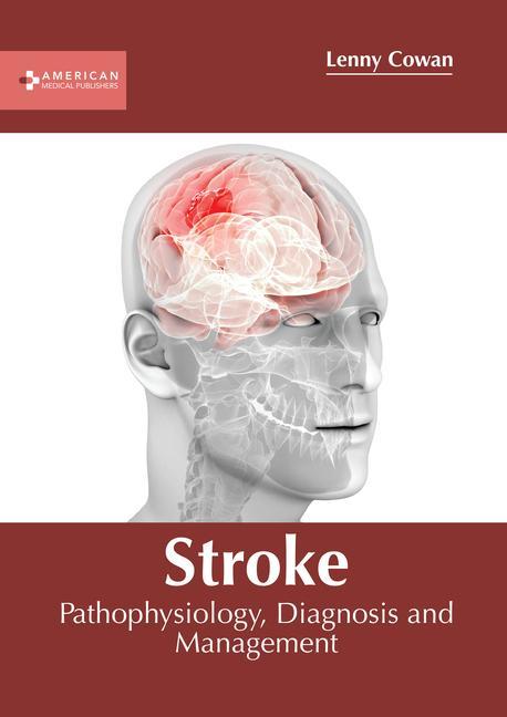 Stroke: Pathophysiology Diagnosis and Management