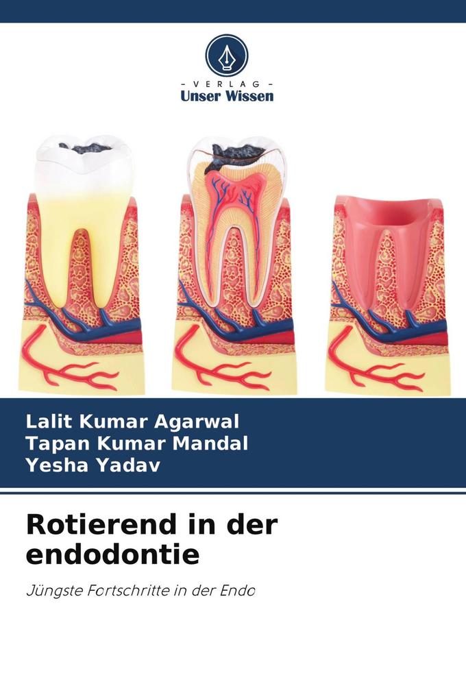 Rotierend in der endodontie