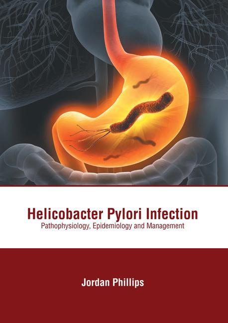 Helicobacter Pylori Infection: Pathophysiology Epidemiology and Management