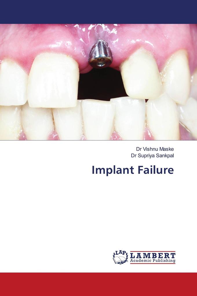 Implant Failure