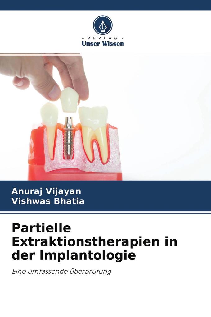 Partielle Extraktionstherapien in der Implantologie