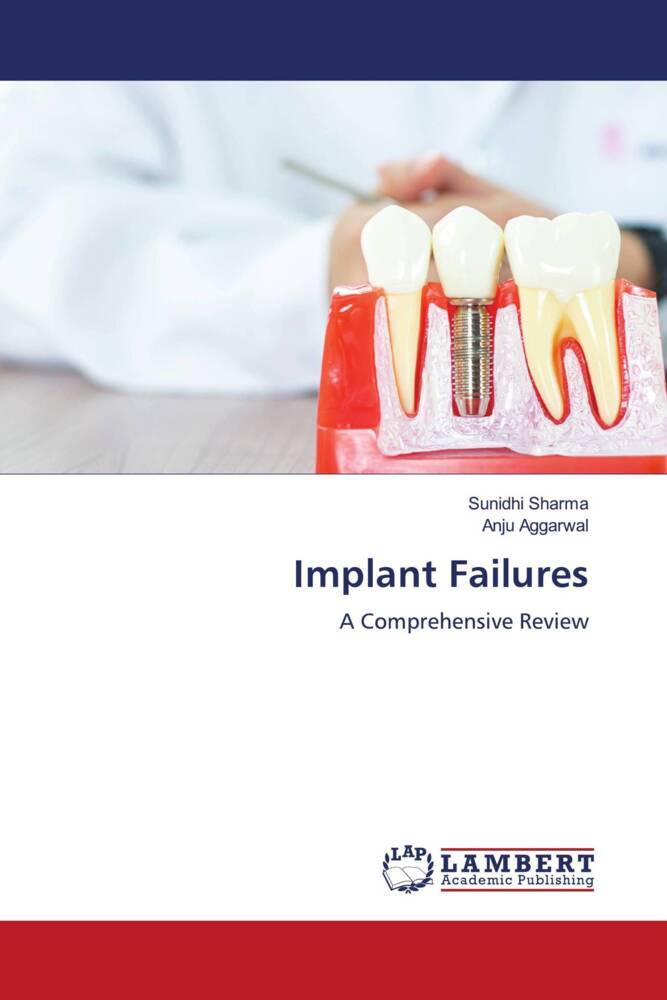Implant Failures