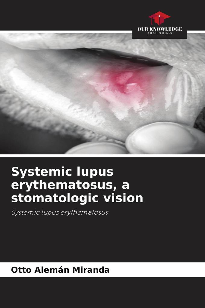 Systemic lupus erythematosus a stomatologic vision