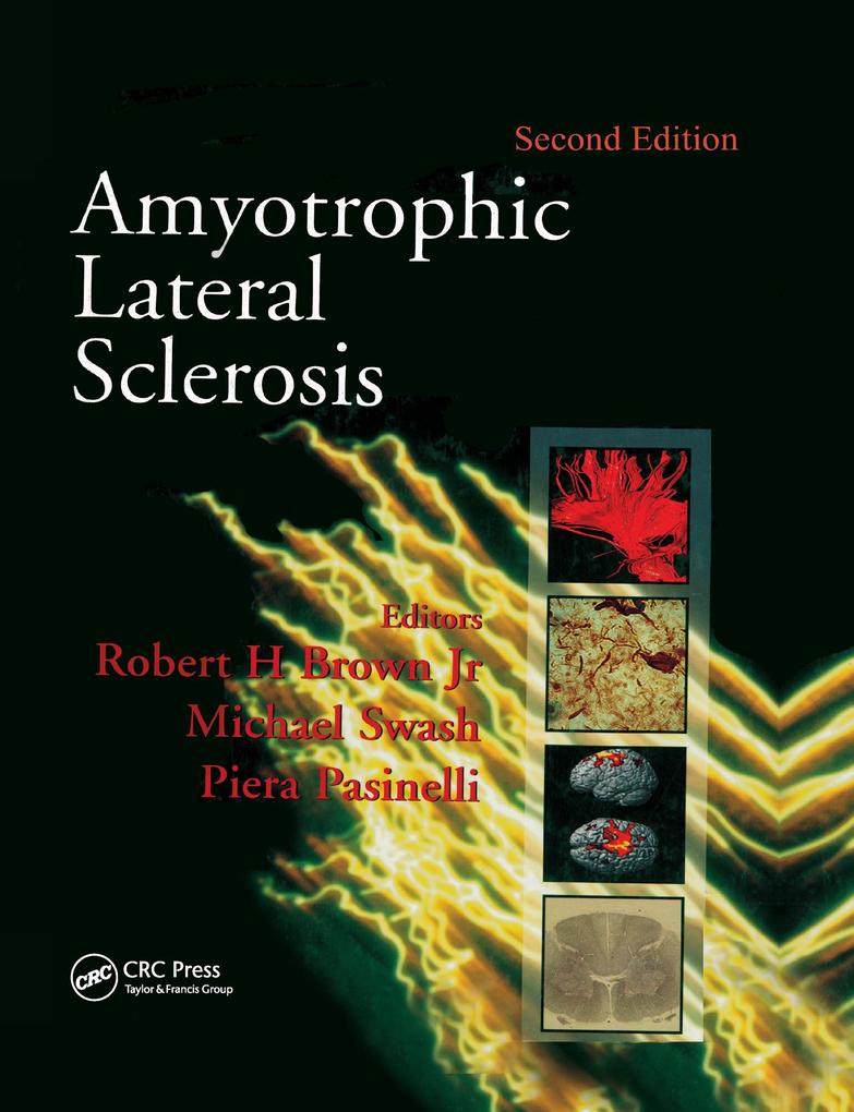 Amyotrophic Lateral Sclerosis Second Edition