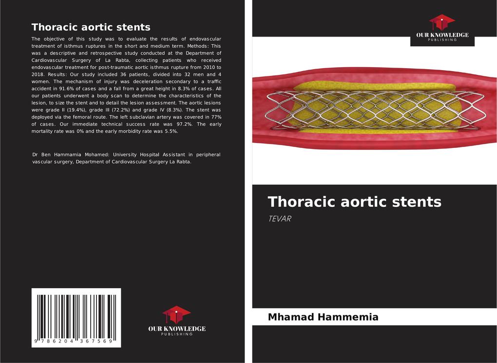 Thoracic aortic stents