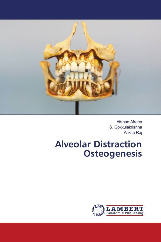 Alveolar Distraction Osteogenesis