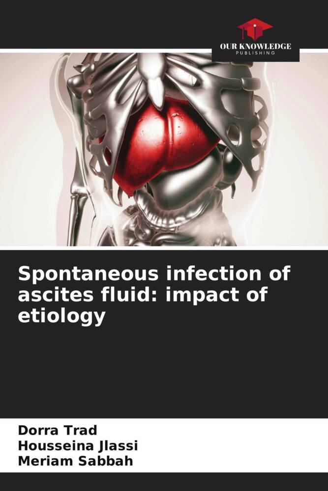 Spontaneous infection of ascites fluid: impact of etiology