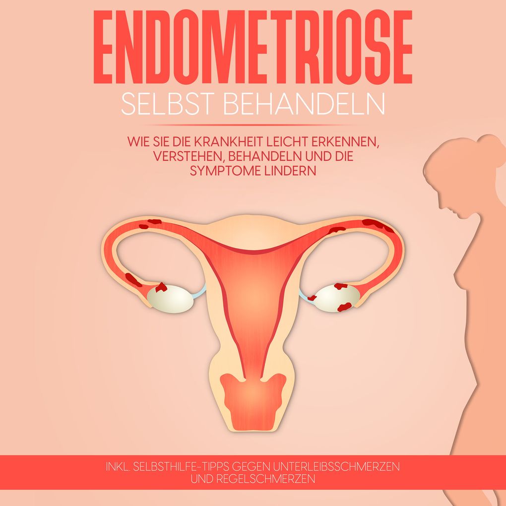 Endometriose selbst behandeln: Wie Sie die Krankheit leicht erkennen verstehen behandeln und die Symptome lindern - inkl. Selbsthilfe-Tipps gegen Unterleibsschmerzen und Regelschmerzen