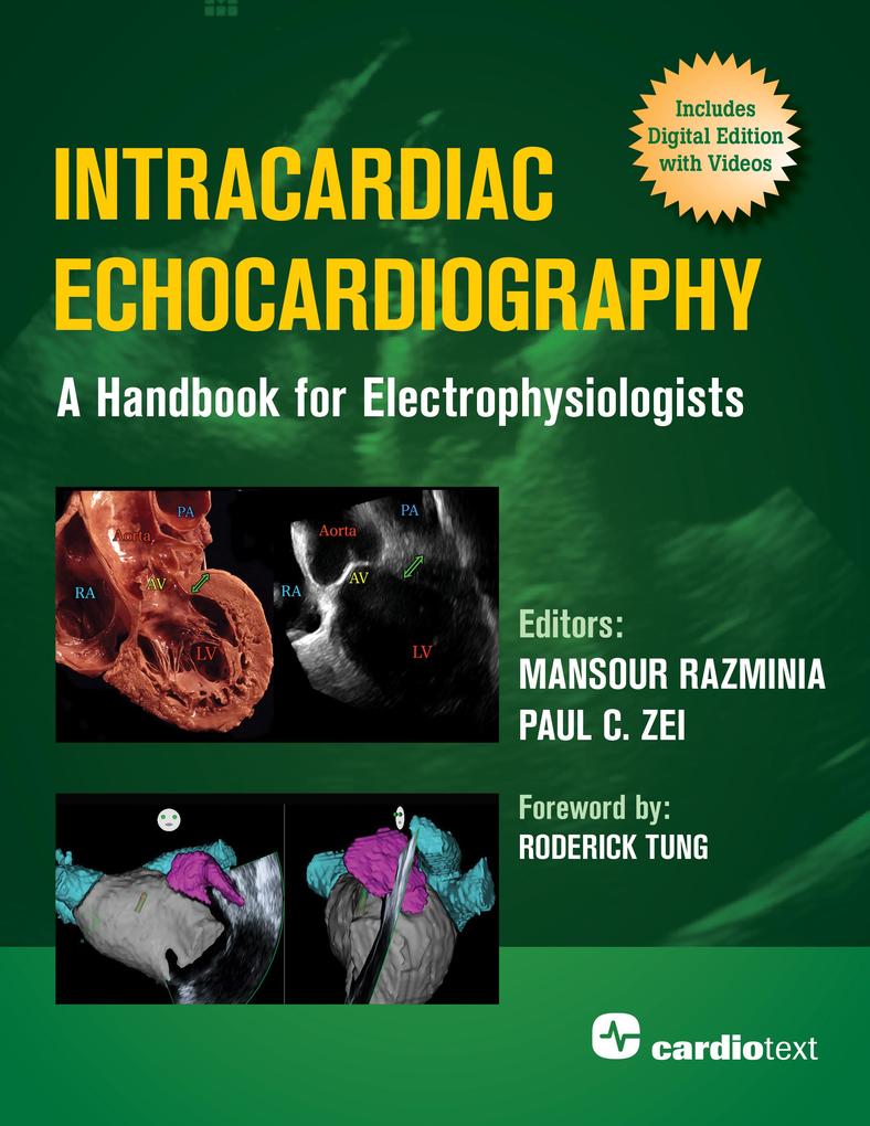 Intracardiac Echocardiography: A Handbook for Electrophysiologists