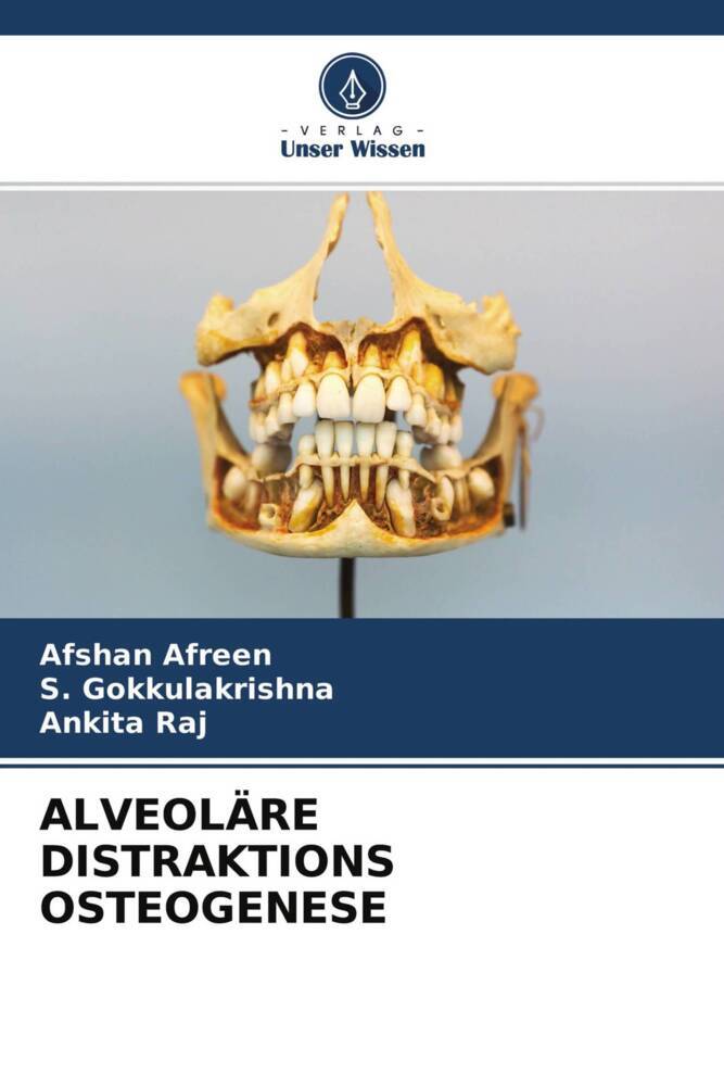 ALVEOLÄRE DISTRAKTIONS OSTEOGENESE