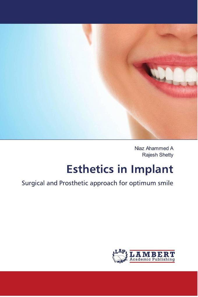 Esthetics in Implant