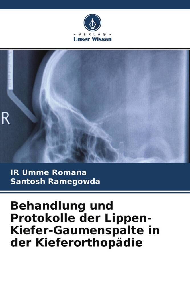 Behandlung und Protokolle der Lippen-Kiefer-Gaumenspalte in der Kieferorthopädie