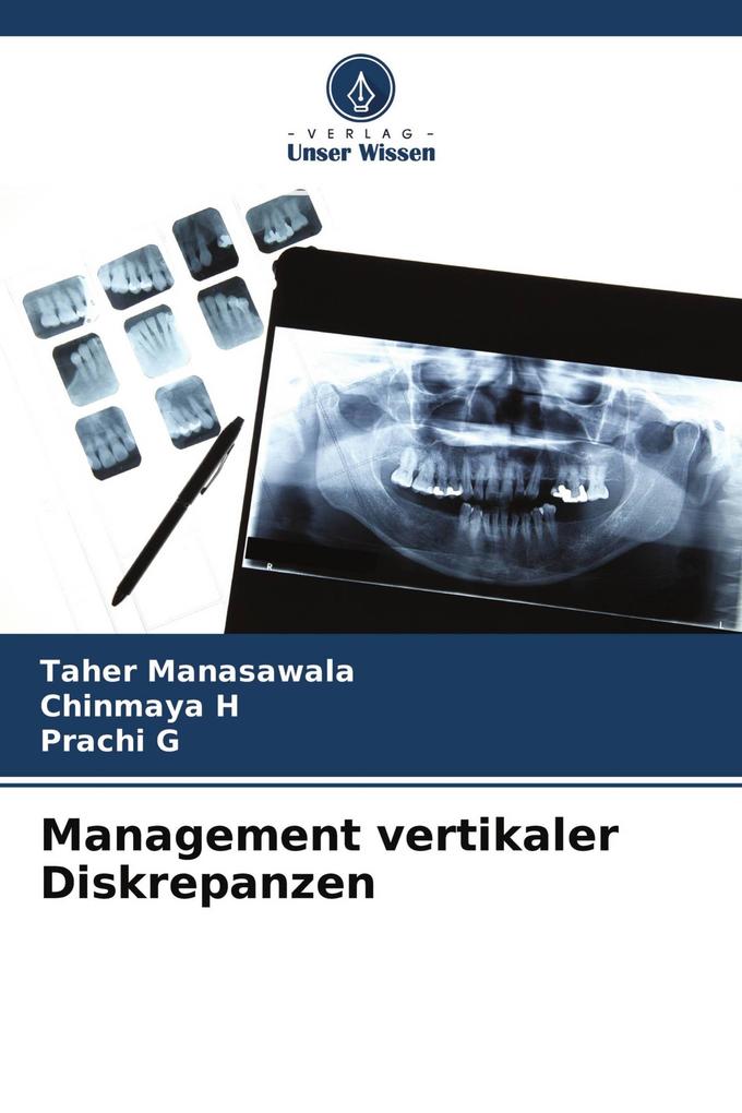 Management vertikaler Diskrepanzen