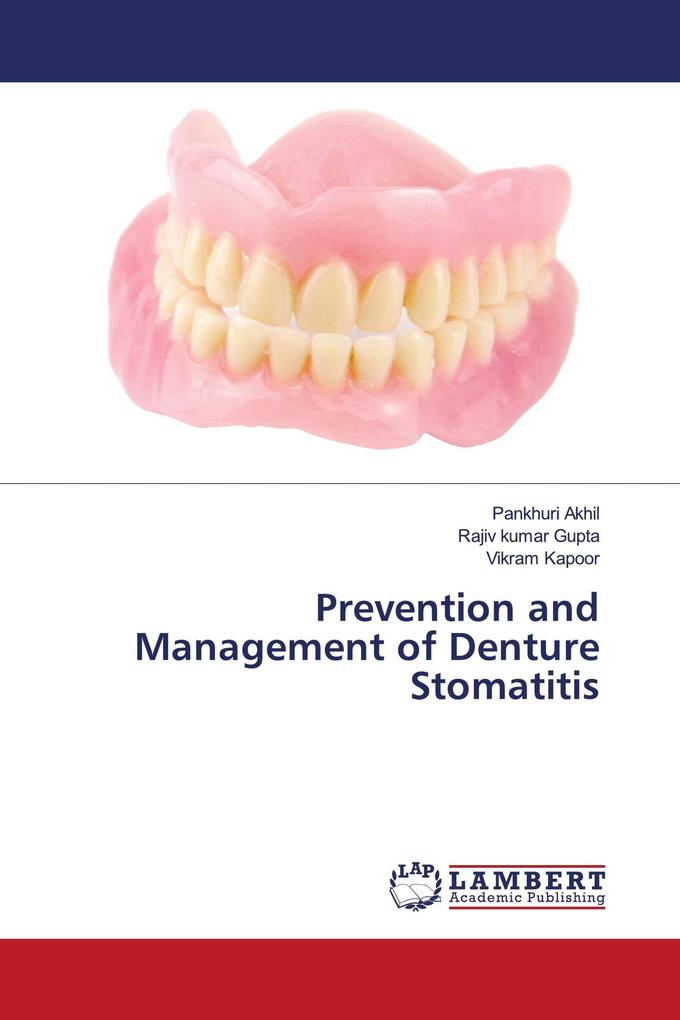 Prevention and Management of Denture Stomatitis