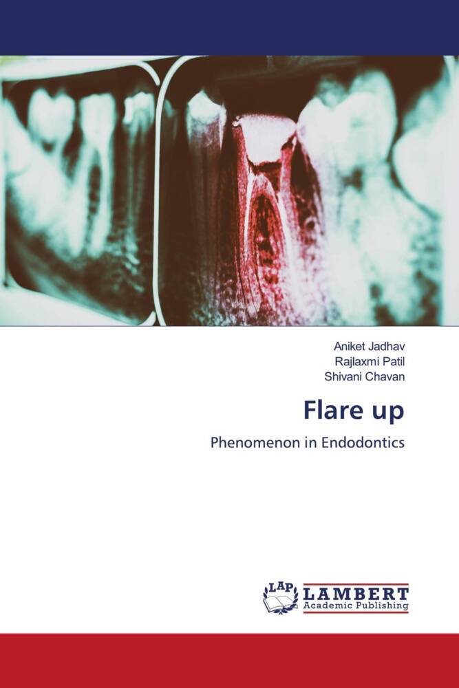 Flare up