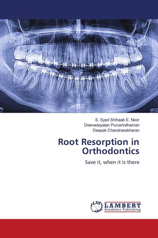 Root Resorption in Orthodontics